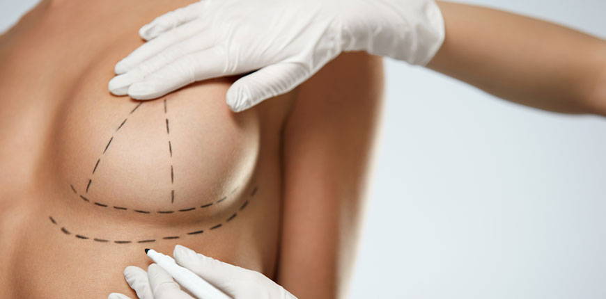 Breast Lift Surgery